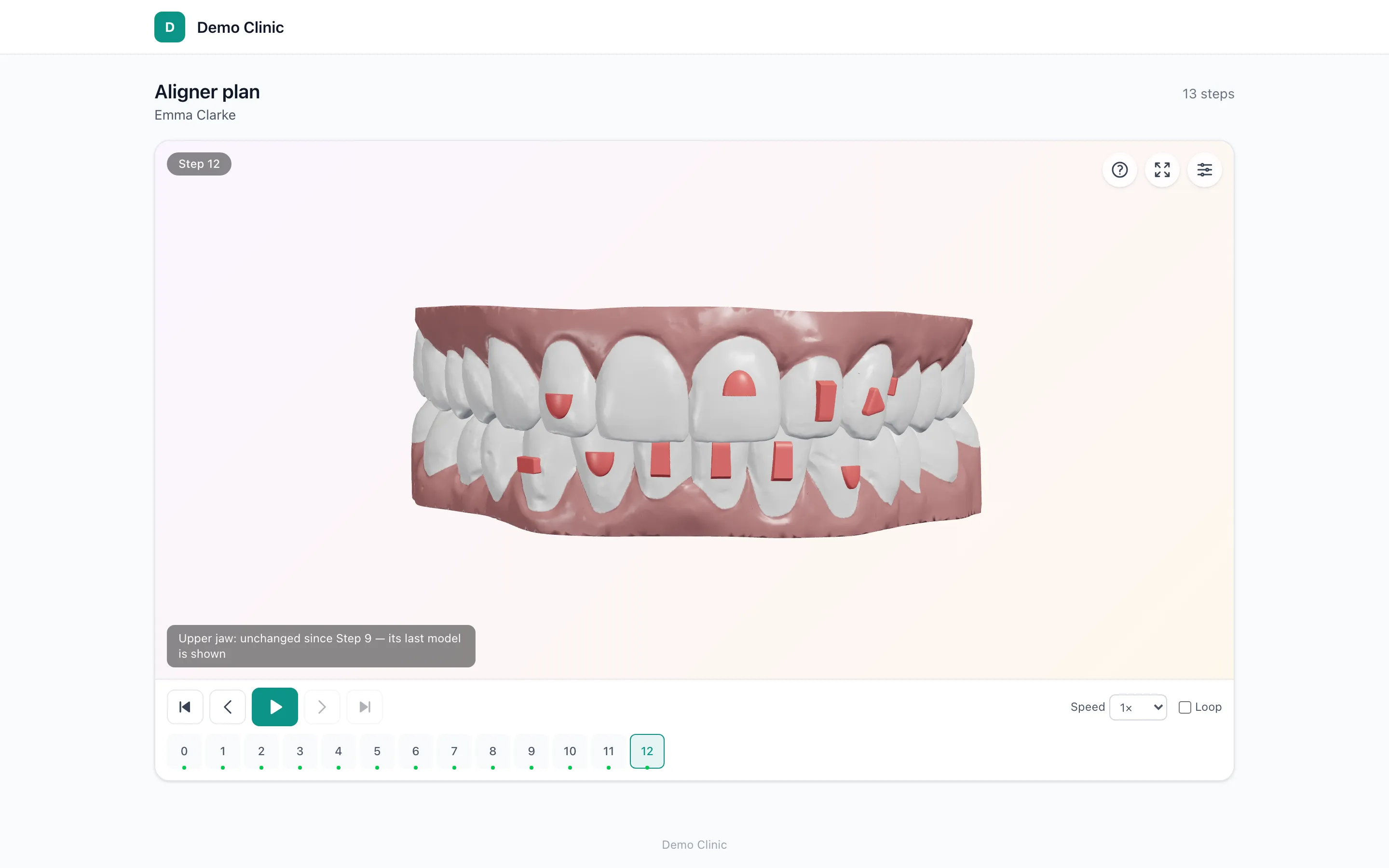 Die 3D-Ansicht von Dentify3D mit dem letzten Schritt einer Aligner-Behandlung samt Attachments